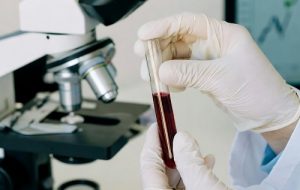 ارتباط «مواد شیمیایی همیشگی» تو خون مادران با تغییرات مغزی بچه‌هاشون